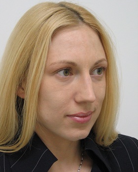 лифтинг